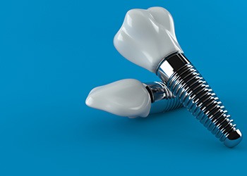 Dental implants on a blue background