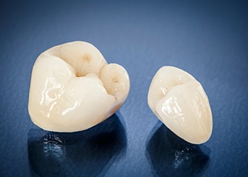 A closeup of ceramic dental crowns